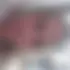 Alla
